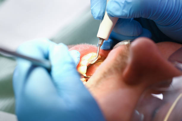 Best Knocked-Out Tooth Emergency  in Murrysville, PA